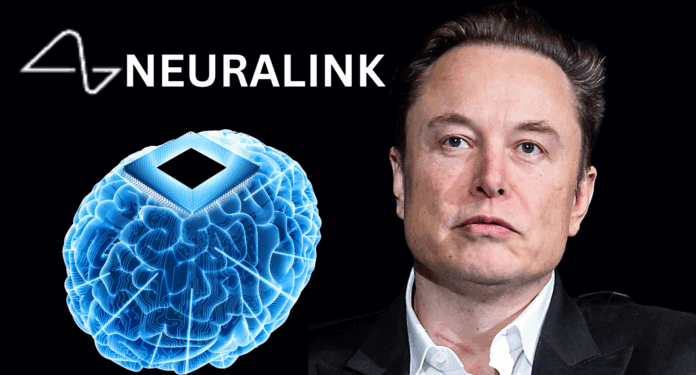 Elon Musk's Neuralink Achieves Breakthrough in Brain Implant Technology – My Startup Life